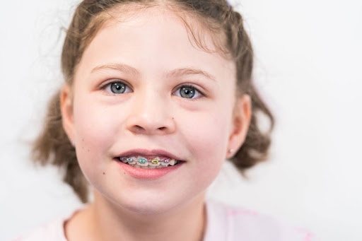 little girl with colorful partial braces callan orthodontics