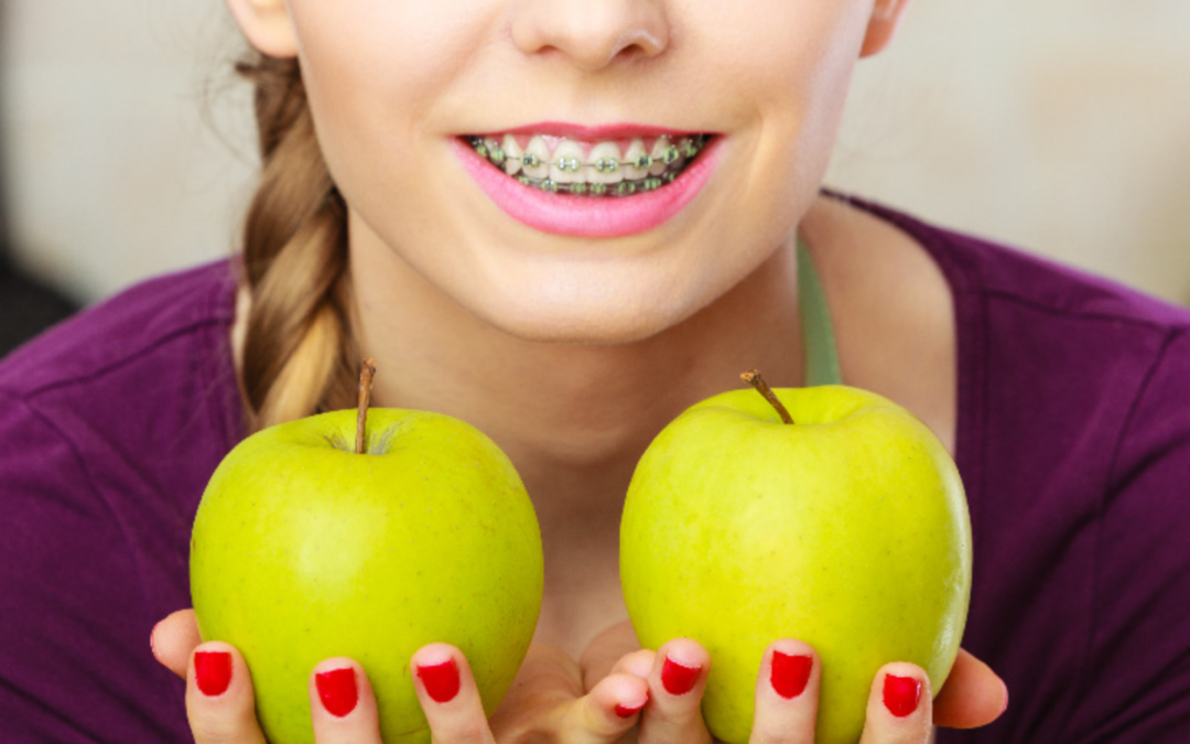 What Foods Should Kids Avoid With Braces?