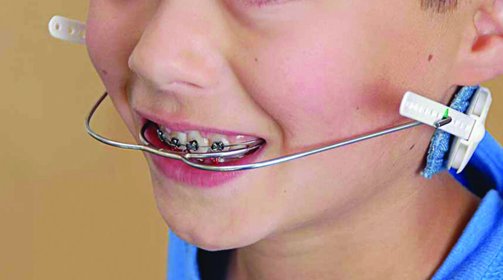 Early Orthodontic Evaluation for Kids | Lawrenceville, NJ