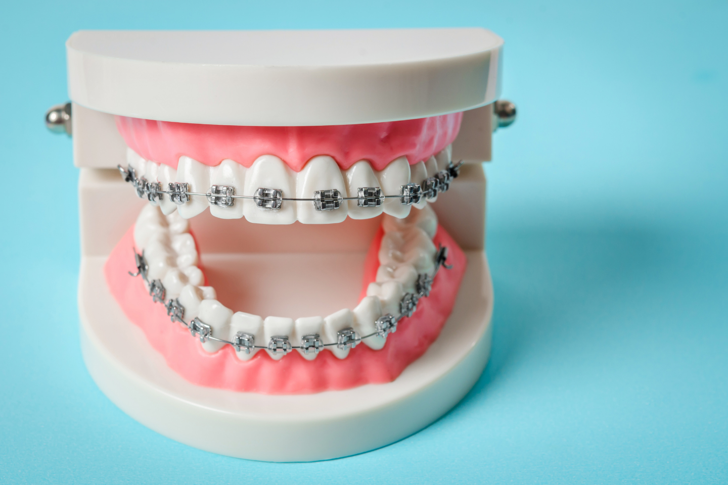 Braces Hurt Does Invisalign Hurt More Than Braces?